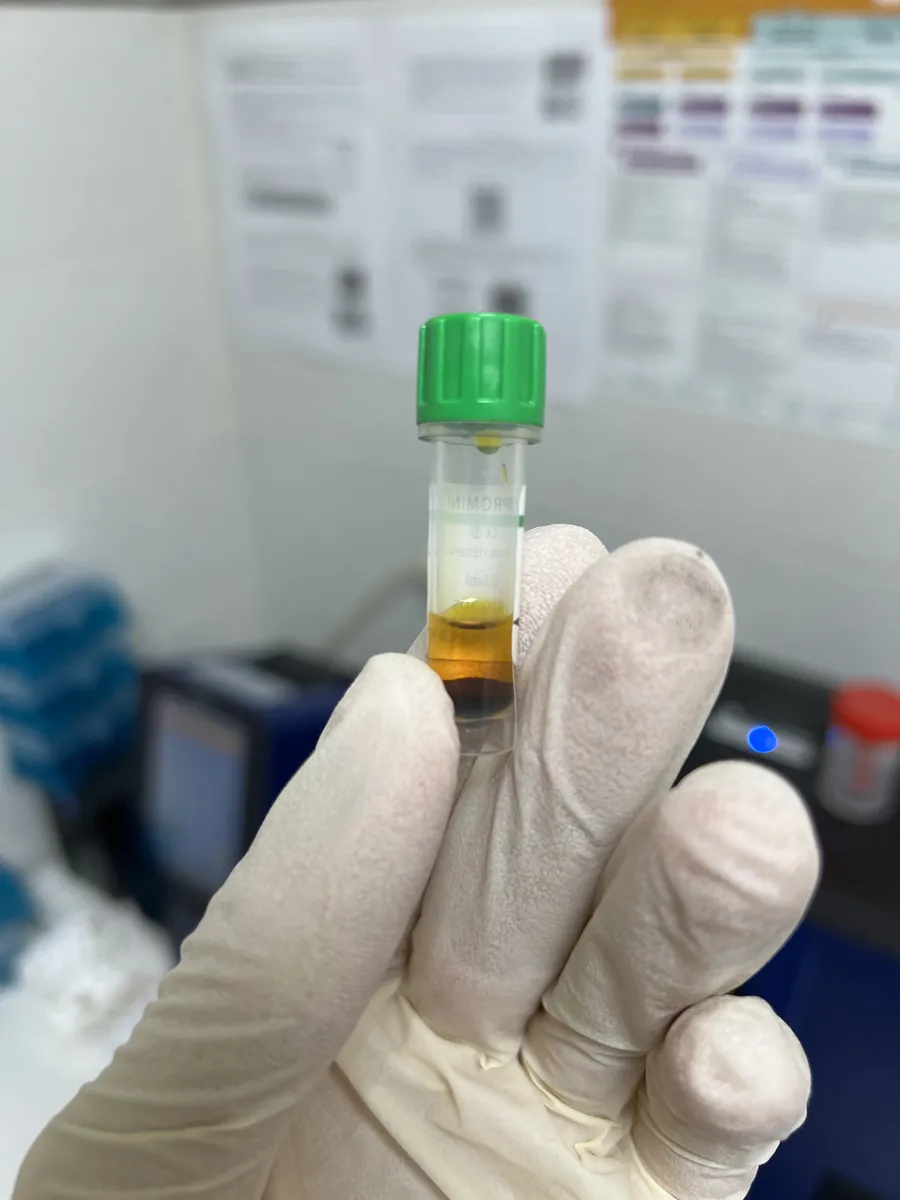 Gloved hand holding a laboratory sample tube in a veterinary clinic